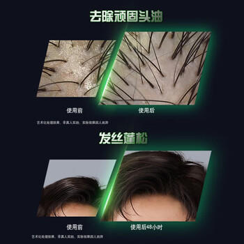 清扬男士劲能瓶洗发水控油蓬松380g清爽去屑洗头膏田栩宁同款京东自营 /个人护理 /洗发护发 /洗发水 商品图3