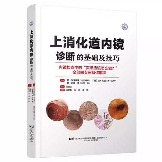 上消化道内镜诊断的基础及技巧 商品图0