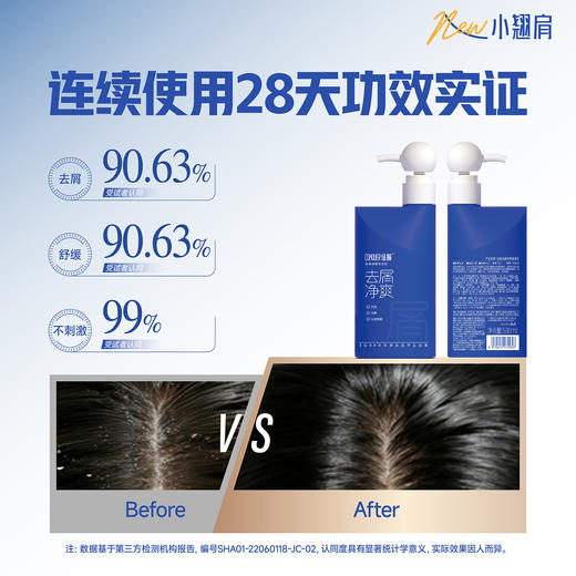 第3代新升级！2026新款 征服青蒿止痒洗发水小翘肩系列，生姜强韧、去屑净爽、控油蓬松、滋养柔顺系列洗发乳 商品图10