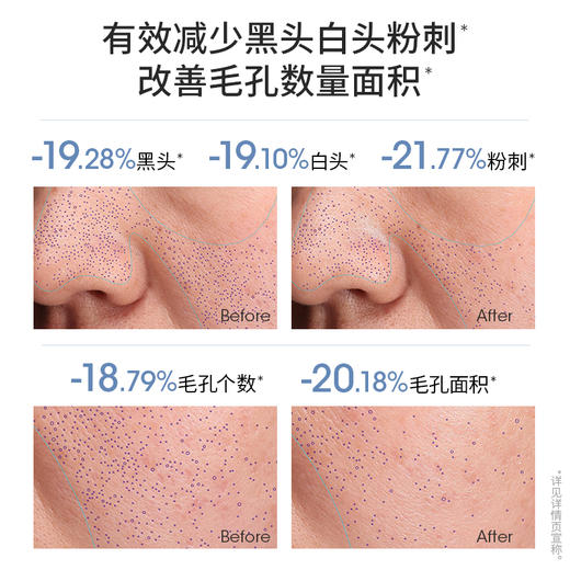 稚优泉（CHIOTURE）臻养卸妆油膏洗卸养三合一深层清洁温和不糊脸卸妆油学生 商品图1