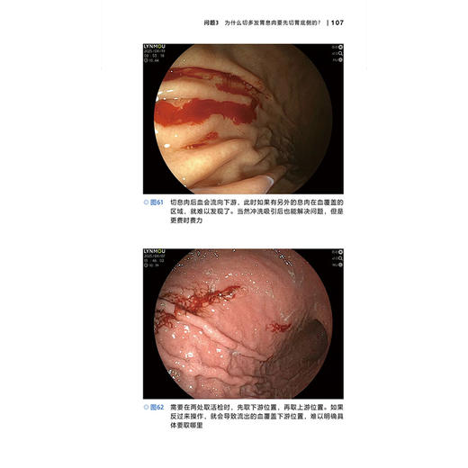 老宫漫谈上消化道内镜篇 宫健 胡洋 李亚冈 为临床一线的内镜专家教授从实践和教学两方面入手 9787559143761辽宁科学技术出版社 商品图3