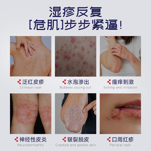 Breathy舒疹膏 商品图1