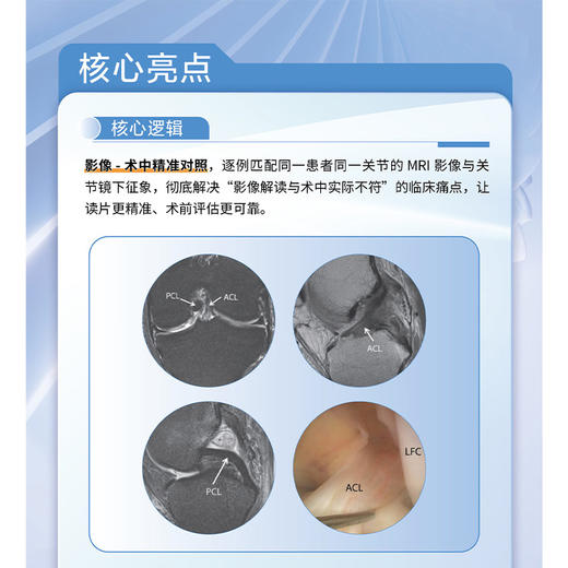 关节磁共振成像与关节镜图谱 第2二版 杨峰 阿良 朴成浩 主译 骨科运动医学MRI技术 骨科学 9787559143976 辽宁科学技术出版社 商品图3