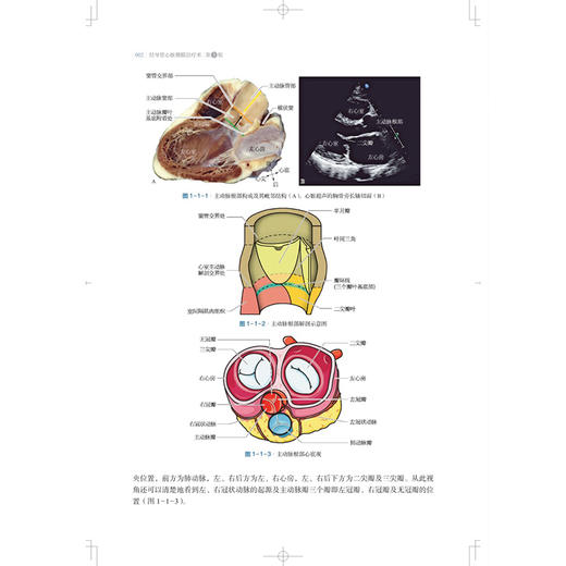 经导管心脏瓣膜治疗术 第3三版 葛均波 周达新 潘文志 主编 先进的技术与器械 葛均波院士团队特色实战经验 上海科学技术出版社 商品图4