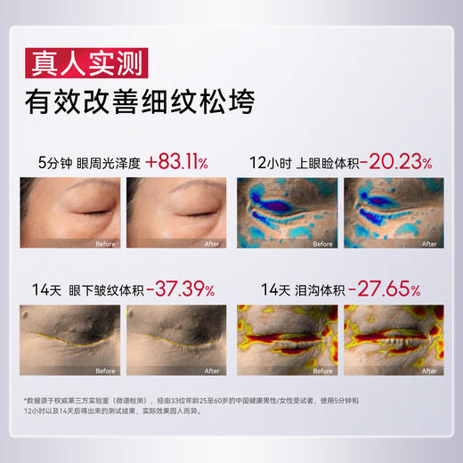 觅光AMIRO光电小熨斗眼霜PDRN美眼仪抗皱紧致淡化黑眼圈细纹按摩 商品图2