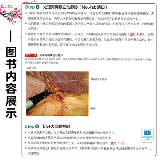 思辨与共识：上消化道术式的优劣与奥义 (日)白石宪男 主编 王利明 主译 适合上消化道外科领域的专业人士阅读 辽宁科学技术出版社 商品图4
