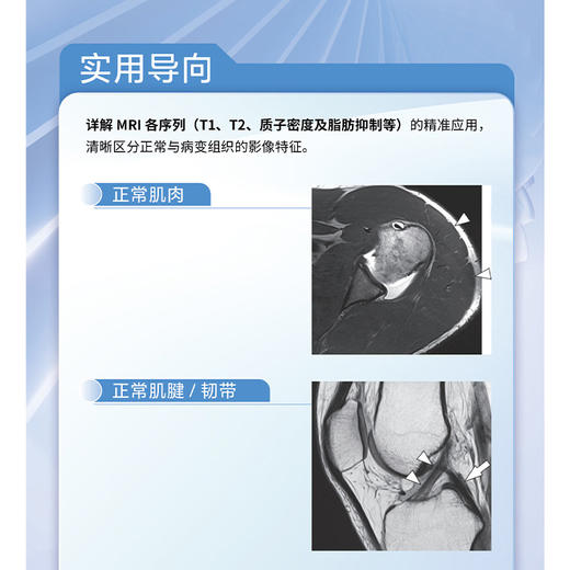 关节磁共振成像与关节镜图谱 第2二版 杨峰 阿良 朴成浩 主译 骨科运动医学MRI技术 骨科学 9787559143976 辽宁科学技术出版社 商品图4
