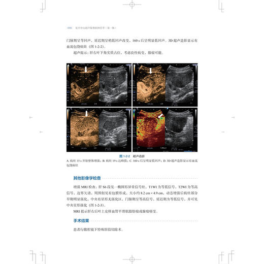 复旦中山超声疑难病例荟萃 第一辑 王文平 闻捷先 舒先红 涵盖超声各领域包括腹部介入等各种临床罕见疑难疾病 上海科学技术出版社 商品图4