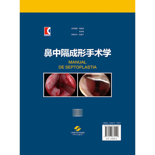 鼻中隔成形手术学 王卫华 主译 耳鼻咽喉头颈外科、整形外科相关医师及研究人员 以及相关专业医学生参考阅读 上海科学技术出版社 商品图2