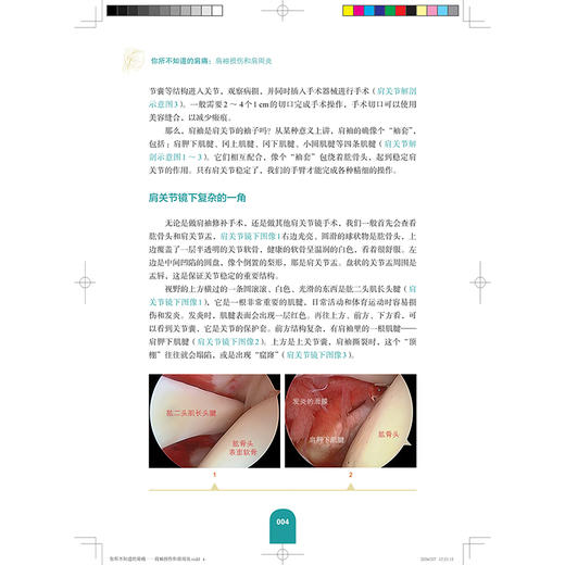你所不知道的肩痛：肩袖损伤和肩周炎 杨春喜 肩痛患者的良师益友 资深关节外科专家编写 你的肩痛应急手册 上海科学技术出版社 商品图4
