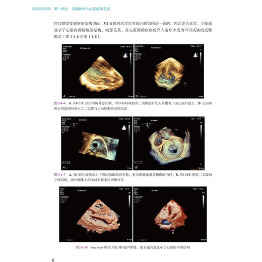 无辐射介入心脏病学 潘湘斌 主编 系统总结近年来在无辐射介入领域的研究进展与临床实践经验 9787565935022 北京大学医学出版社 商品图4