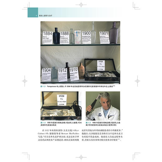 脱发:进展与治疗 宋秀祖 主译 系统阐释脱发诊疗的临床进展与前沿突破 皮肤与性病学 皮肤病学 9787547876015 上海科学技术出版社 商品图4