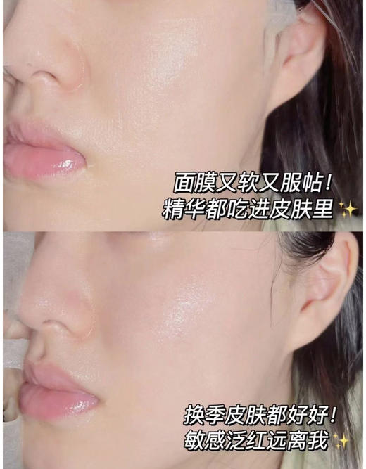 绽妍小水库面膜安润保湿面膜1盒5片干皮补水保湿马齿苋舒缓敏感 商品图5