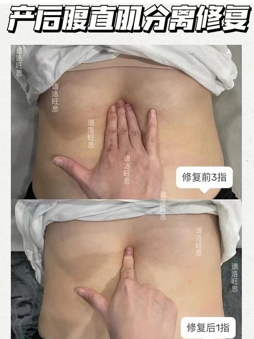 plws-悦享平衡尊享套（腹直肌） 私密套 买十送一产后 商品图3