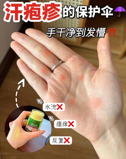 【JXXINLIN泰国 汗疱膏】皮肤问题克星!好用到没朋友不含任何激素，功能全面简直就是皮肤问题的"克星" 商品图3