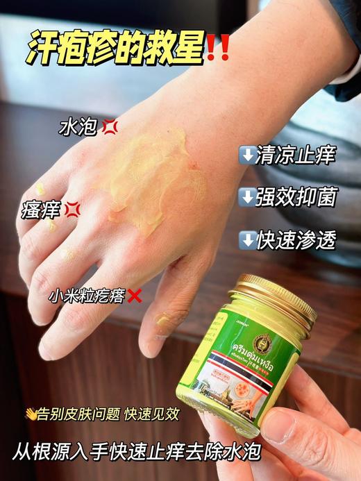 【JXXINLIN泰国 汗疱膏】皮肤问题克星!好用到没朋友不含任何激素，功能全面简直就是皮肤问题的"克星" 商品图5