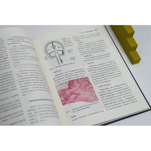 法医神经病理学精要 [美]胡安·C.特龙科索[美]安娜·卢比奥[美]戴维·R.福勒著 法律出版社 商品图2