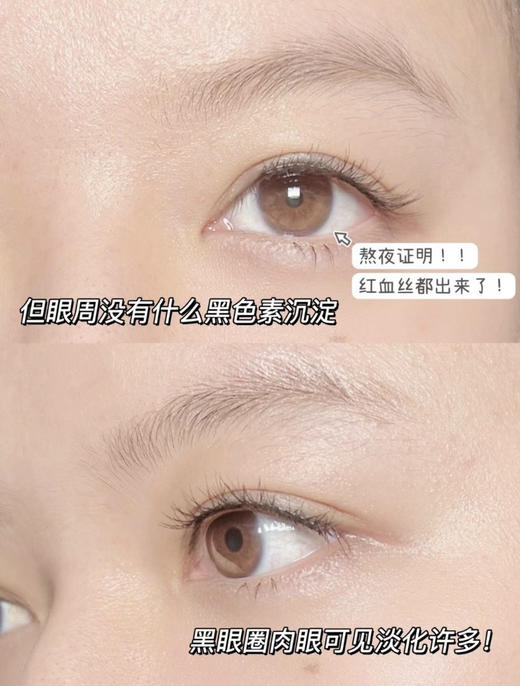 直发 【发三瓶*5ml】正装量 雅诗兰黛小样抗蓝光眼霜 商品图4