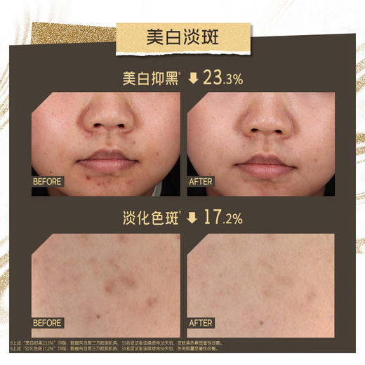 【大促独享】diary言之有物耀白淡斑精华577美白精华1ml*30支/盒*3送同款577面霜50g+577面膜5片（新品上市 美白特证） 商品图2