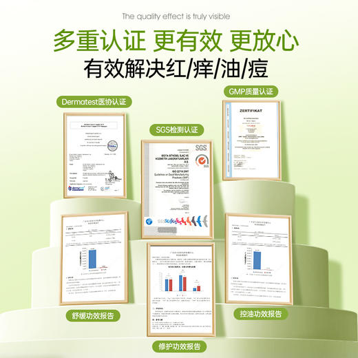 【可儿姐专属】Bioblas大蒜毛囊洗发水除螨炎去屑止痒头皮清洁控油蓬松洗头膏露 商品图5