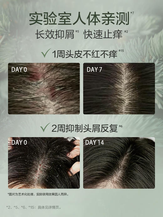 阿道夫天然香植物香氛洗发露(头皮去屑)618ml 商品图1