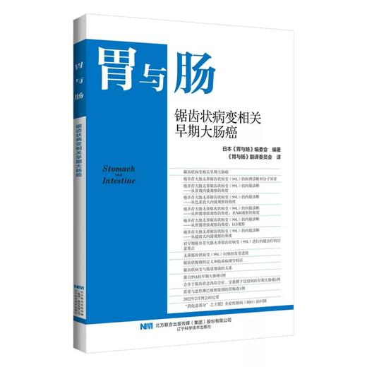 锯齿状病变相关早期大肠癌 商品图0