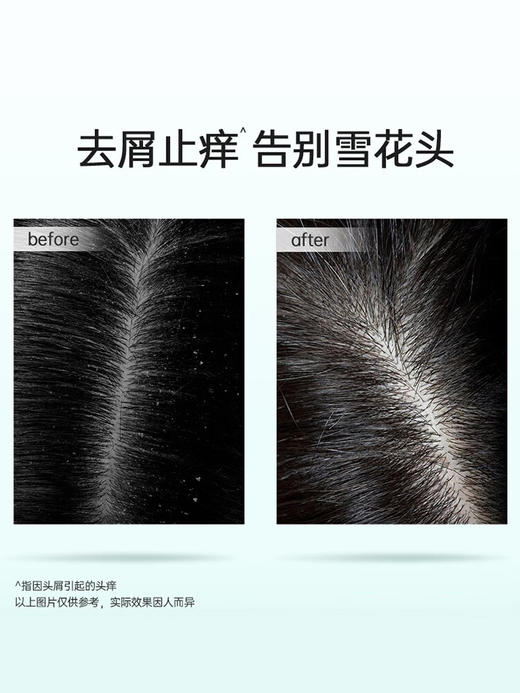 滋源茶籽控油去屑洗头水400ml 商品图2