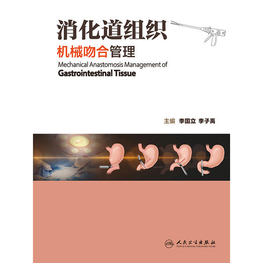 【预售】消化道组织机械吻合管理 商品图1