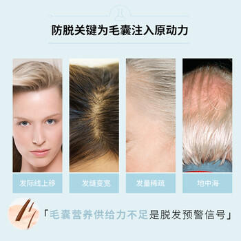 养元青防脱头皮深层养护防脱发植物草本防脱精华液50ml*2 商品图5