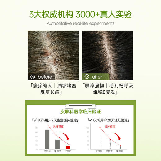 【可儿姐专属】Bioblas大蒜毛囊洗发水除螨炎去屑止痒头皮清洁控油蓬松洗头膏露 商品图3