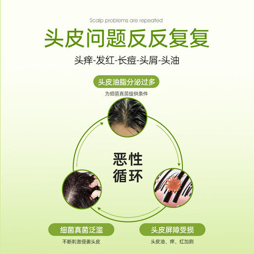 【可儿姐专属】Bioblas大蒜毛囊洗发水除螨炎去屑止痒头皮清洁控油蓬松洗头膏露 商品图1