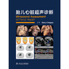 【预售】胎儿心脏超声诊断 商品缩略图1