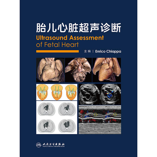 【预售】胎儿心脏超声诊断 商品图1