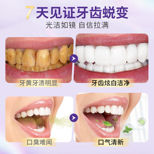 【亮白不酸牙，口气持久清爽】韩伦美羽专研去渍美白牙膏7天去黄爆珠去烟渍牙渍美白色修牙膏。xb 商品图2