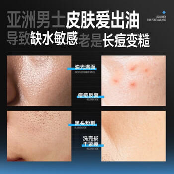 左颜右色男士控油洗面奶男氨基酸祛痘去黑头收缩毛孔护肤品保湿洁面乳150g 商品图1