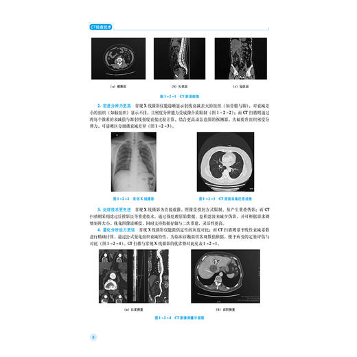 CT检查技术 杨德武 韩晓磊 主编 全国高职高专医学影像技术专业规划教材(第二轮) 教学配套资源(PPT、微课等) 中国医药科技出版社 商品图4