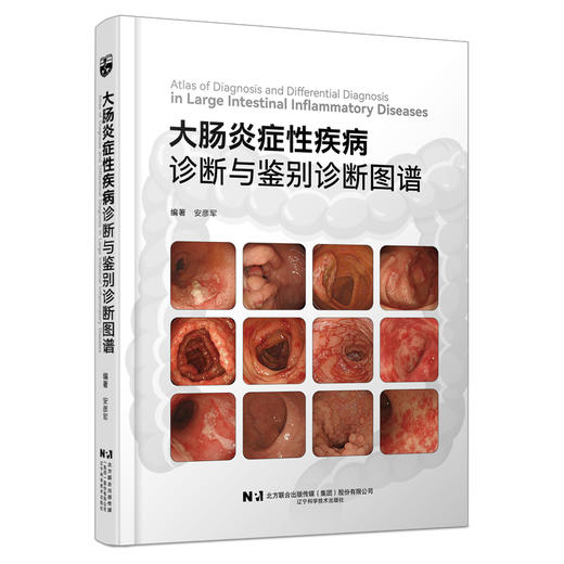 大肠炎症性疾病诊断与鉴别诊断图谱 安彦军 初中级消化内科医师 大肠疾病 炎症 诊断 鉴别诊断 内镜 消化内科 辽宁科学技术出版社 商品图1