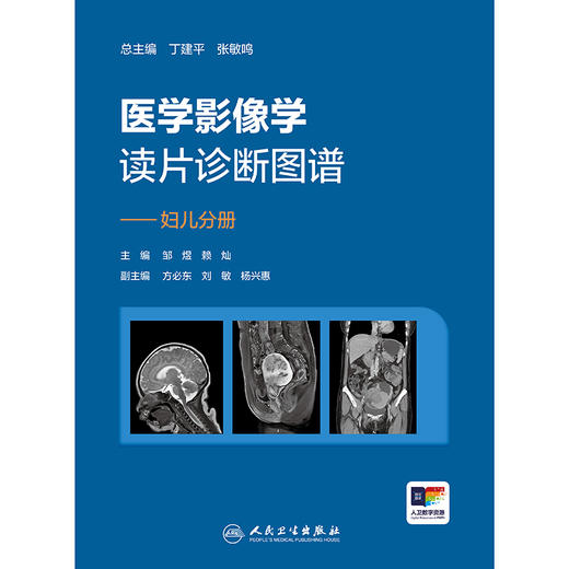 【预售】医学影像学读片诊断图谱——妇儿分册 商品图1