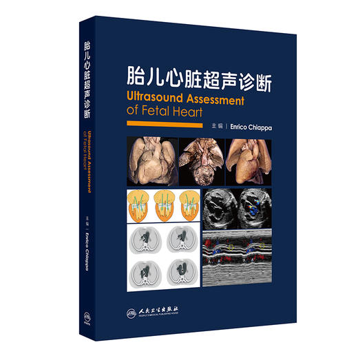 胎儿心脏超声诊断 Enrico Chiappa 主编 适合国内外产科、儿科、心脏外科、超声医学专业从业人员及学生学习阅读 人民卫生出版社 商品图1