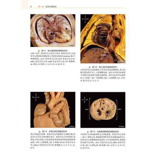 胎儿心脏超声诊断 Enrico Chiappa 主编 适合国内外产科、儿科、心脏外科、超声医学专业从业人员及学生学习阅读 人民卫生出版社 商品图4