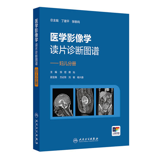 医学影像学读片诊断图谱——妇儿分册 邹煜 赖灿 主编 增加“妇儿分册”，以常见疾病、多发病为主要介绍内容 人民卫生出版社 商品图1