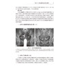 医学影像学读片诊断图谱——妇儿分册 邹煜 赖灿 主编 增加“妇儿分册”，以常见疾病、多发病为主要介绍内容 人民卫生出版社 商品缩略图4