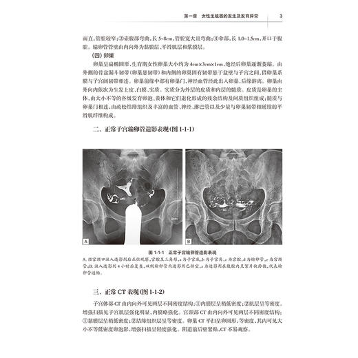 医学影像学读片诊断图谱——妇儿分册 邹煜 赖灿 主编 增加“妇儿分册”，以常见疾病、多发病为主要介绍内容 人民卫生出版社 商品图4