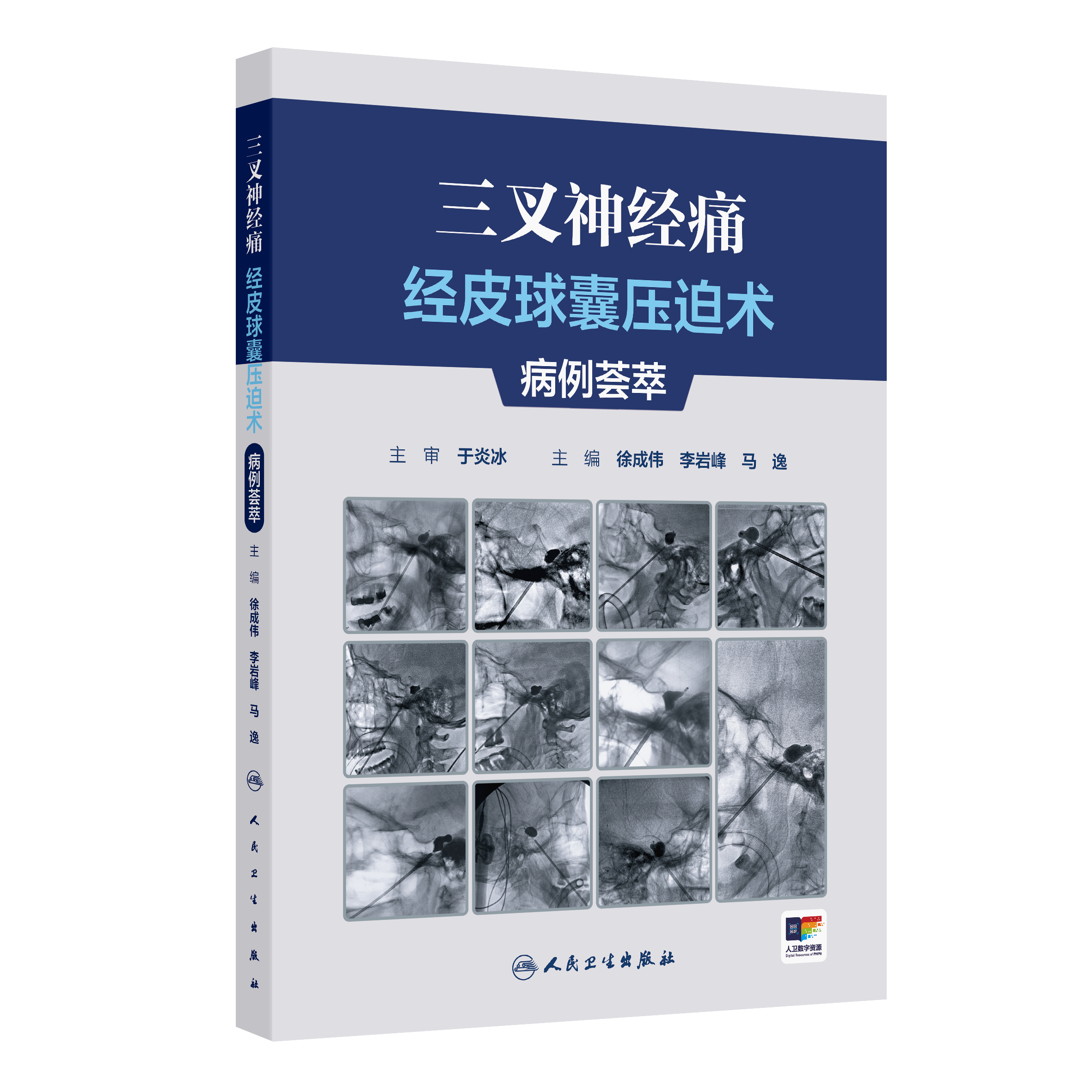 【预售】三叉神经痛经皮球囊压迫术病例荟萃