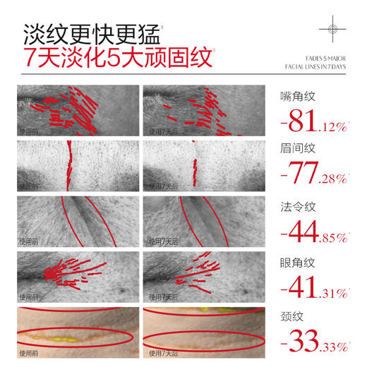 【官方正品】【全新升级胶原小金针精华】丸美重组双胶原蛋白抗皱修护精华液30支/80支   淡纹更快更猛  修红修暗全脸发光 商品图5