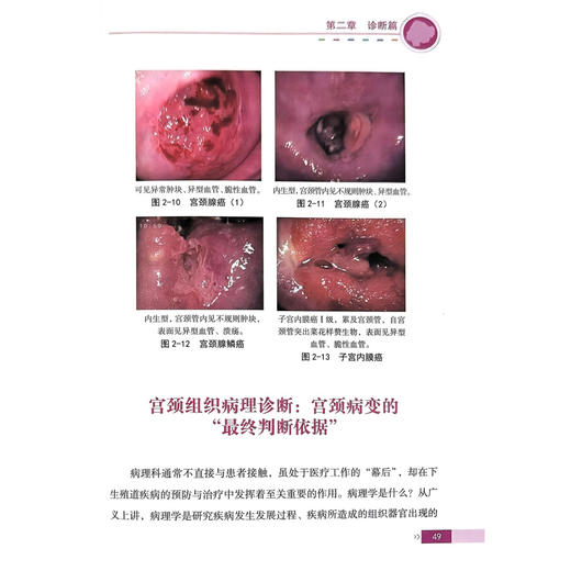 宫颈疾病管理手册 健康中国·疾病管理丛书 马丁 李欢 主编 涌盖了预防、诊断、治疗、康复等方面9787523530146科学技术文献出版社 商品图4