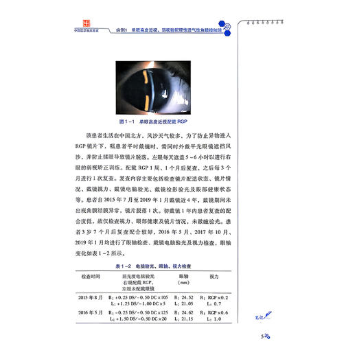 北京同仁医院眼视光病例精解 宋红欣 主编 系统阐述了在特殊角膜条件下RGP的验配要点和处理方案 9787523533529科学技术文献出版社 商品图4