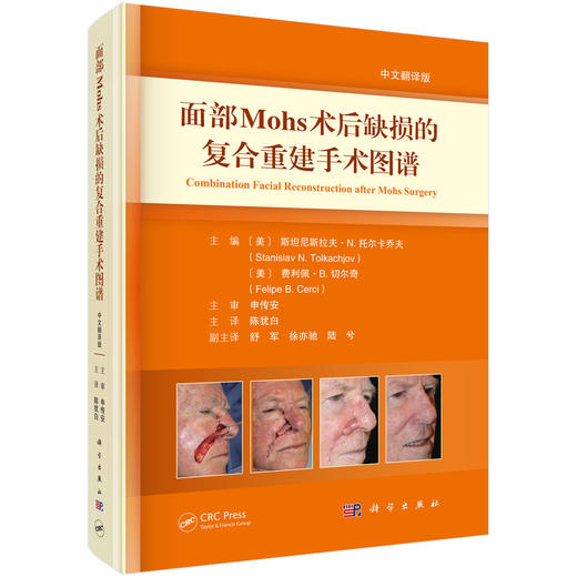 面部Mohs术后缺损的复合重建手术图谱（中文翻译版）陈犹白 主译 为创面修复科眼科等专科医师提供了实用的临床参考 科学出版社 商品图1