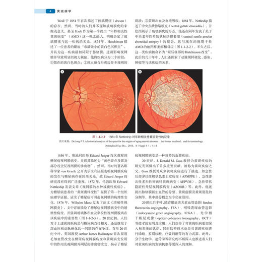 黄斑病学 附赠精彩手术视频 陈有信 主编 1000余幅精美图片以及精彩视频 全面展现黄斑病学领域最新观点和新进展 科学出版社 商品图4