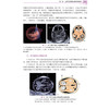 正常胎儿生长发育超声标准参考图谱 李胜利 袁鹰 文华轩 适用于各级医院超声科医师产科医师助产士产科护士等阅读参考 科学出版社 商品缩略图4